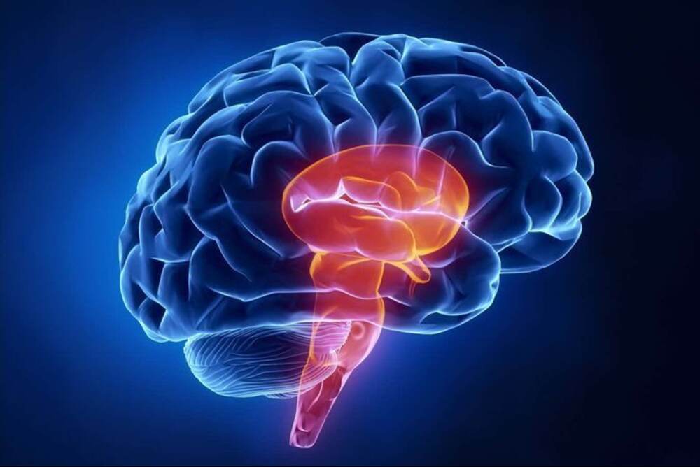 What is a Brain Stroke